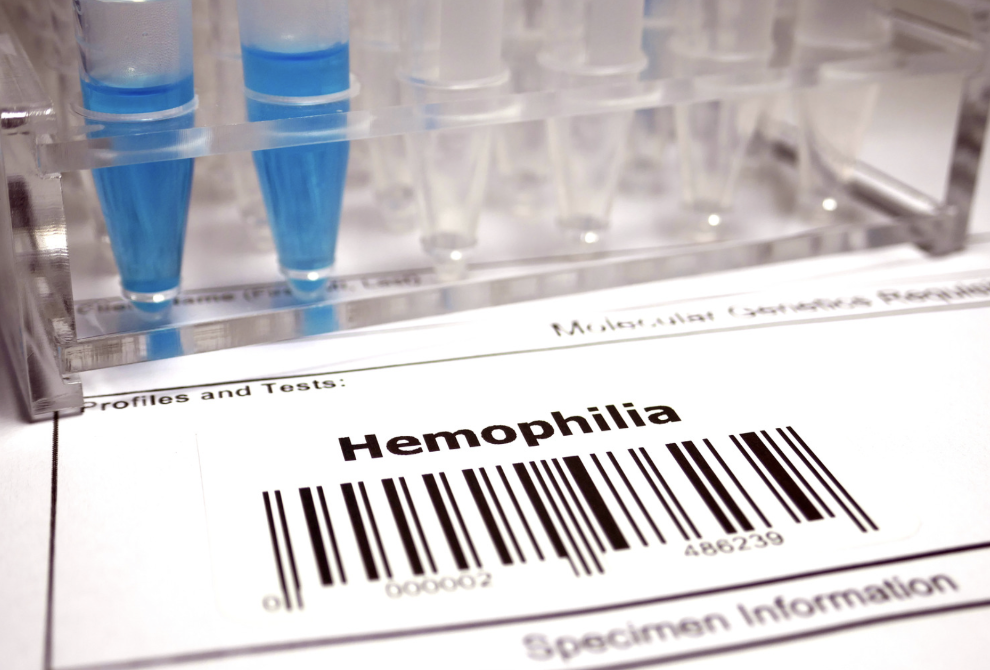 Patient treatment preferences research in hemophilia